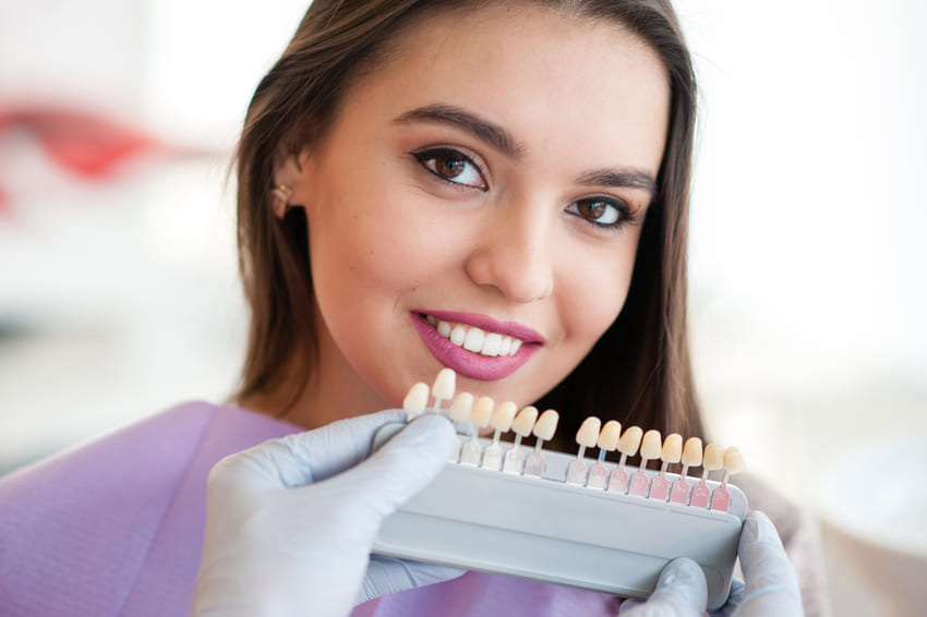 Les avantages d'un traitement de facettes dentaires E-Max